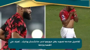 تفاصيل صادمة لصورة بطن مبويمو لاعب مانشستر يونايتد.. تعرف على القصة وراءها